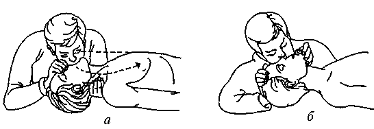 Искусственное дыхание