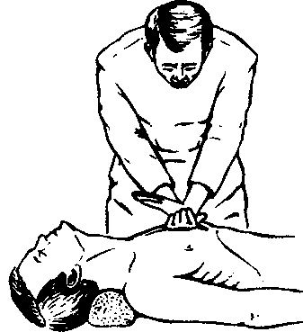 Закрытый массаж сердца